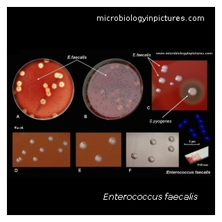 enterococcus